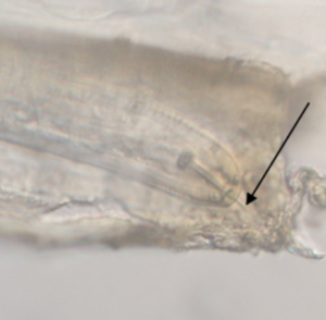 Figure 1: Close up picture of Globodera pallida head (Picture by Rinu Kooliyottil). Arrow pointing to stylet of nematode, used to penetrate plant cell walls. 