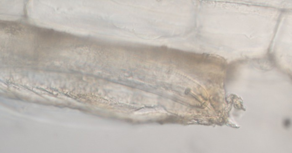 Close up picture of pale cyst nematode (Globodera pallida) head (Rinu Kooliyottil)