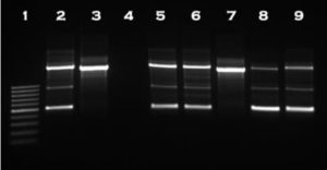 Use of Molecular Markers with Conventional Breeding
