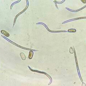 Pale cyst nematode (Globodera pallida) juveniles hatching from egg